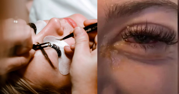 ‘Infeccionou e fiquei com “olhos de zumbi” após fazer extensão de cílios’, diz jovem que se arrumava para formatura; veja vídeo