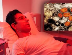 'Tudo ao mesmo tempo': homem testa positivo para varíola dos macacos, HIV e Covid-19