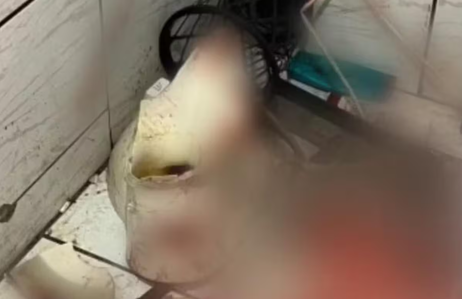 Vaso sanitário quebra e mulher é internada às pressas em UTI