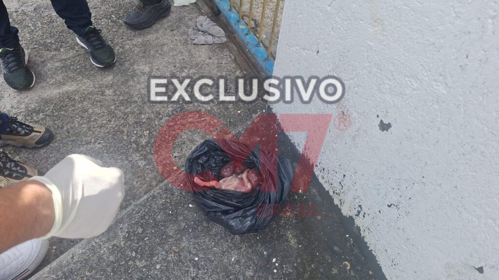 Mulher abandona feto dentro de lixeira no bairro Cidade Nova 1 WhatsApp Image 2025 03 06 at 09.57.56