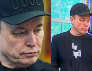 Elon Musk aparece com olho roxo após despedida oficial do Governo Trump; veja vídeo