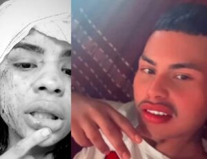 Mulher é espancada e tem rosto desfigurado após rejeitar ficar com jovem em festa de Manaus; veja vídeo