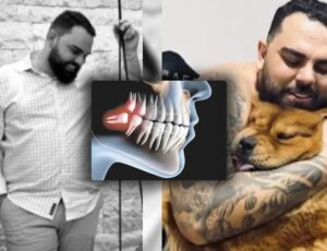 Empresário de 32 anos tem infecção generalizada e morre duas semanas após extrair dente siso; veja vídeo