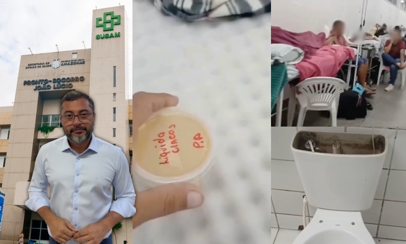 Pacientes nos corredores, banheiros quebrados e 'sopa' de óleo e sal: gestão de Wilson Lima abandona o hospital João Lúcio; veja vídeo