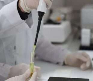 Brasileiro é a 7ª pessoa no mundo a ser curado do HIV com tratamento inovador da Unifesp